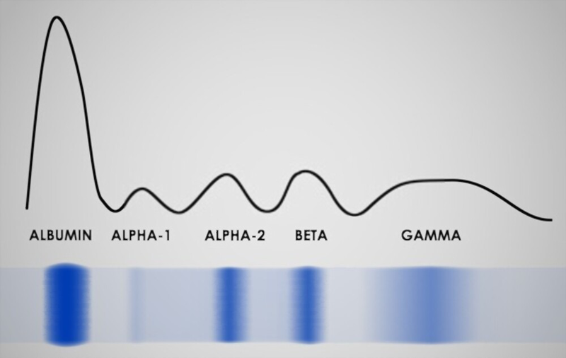 Điện di protein huyết thanh (SPEP)