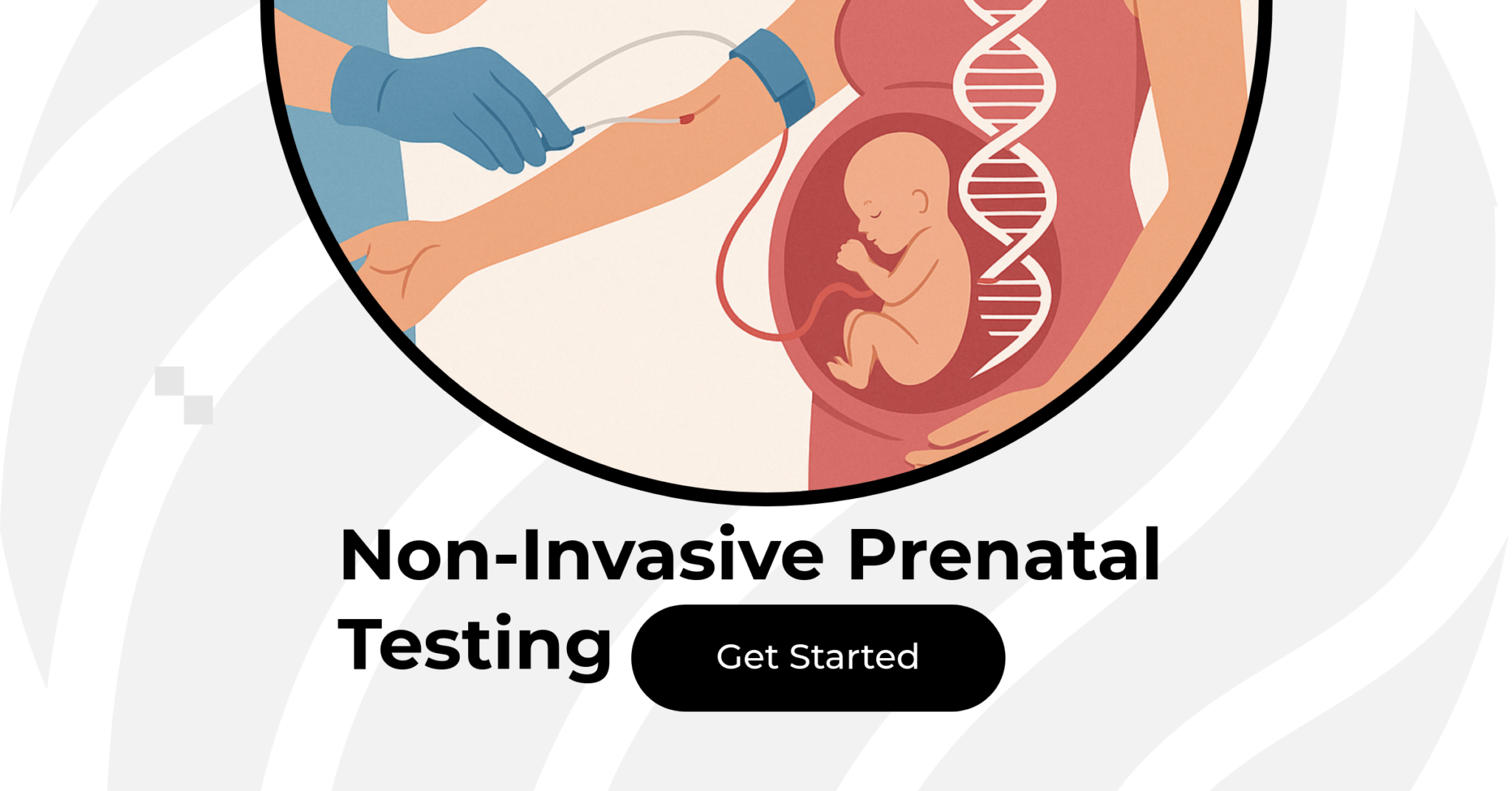 NIPT (Non-Invasive Prenatal Testing)
