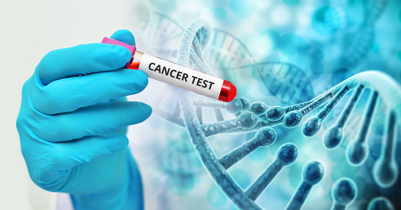 Hereditary Cancer Genetic Screening: Early Risk Detection
