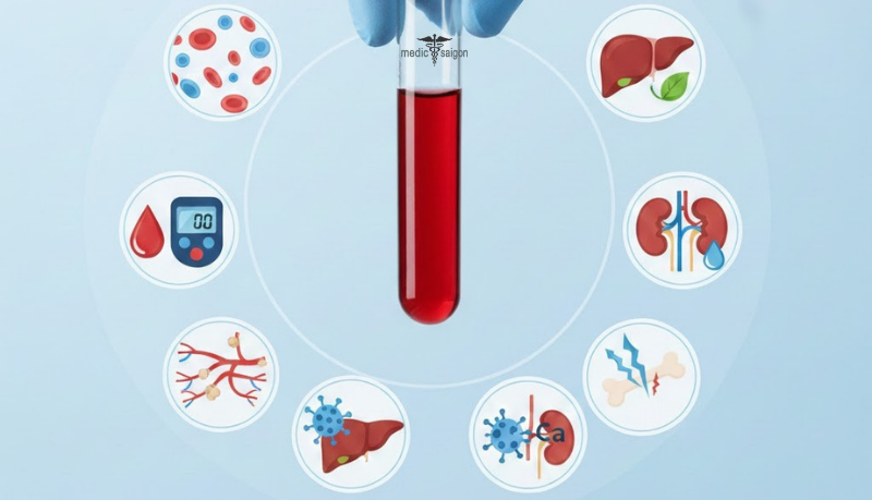 xet- nghiem-mau-tong-quát-2