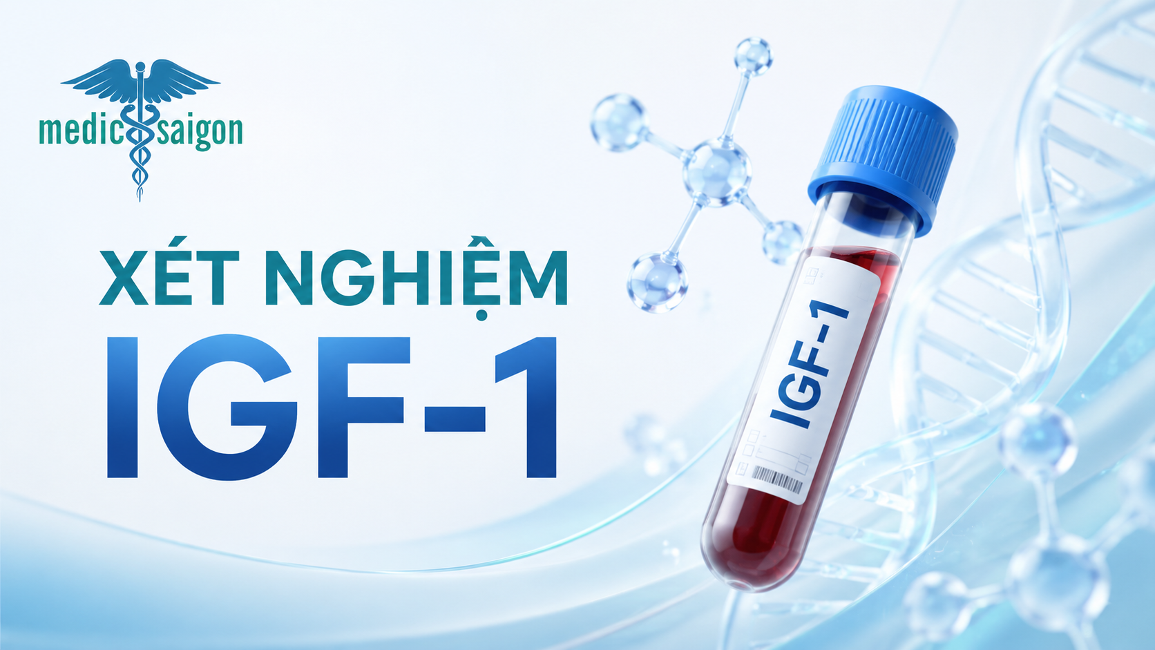 Xét nghiệm IGF-1 là gì