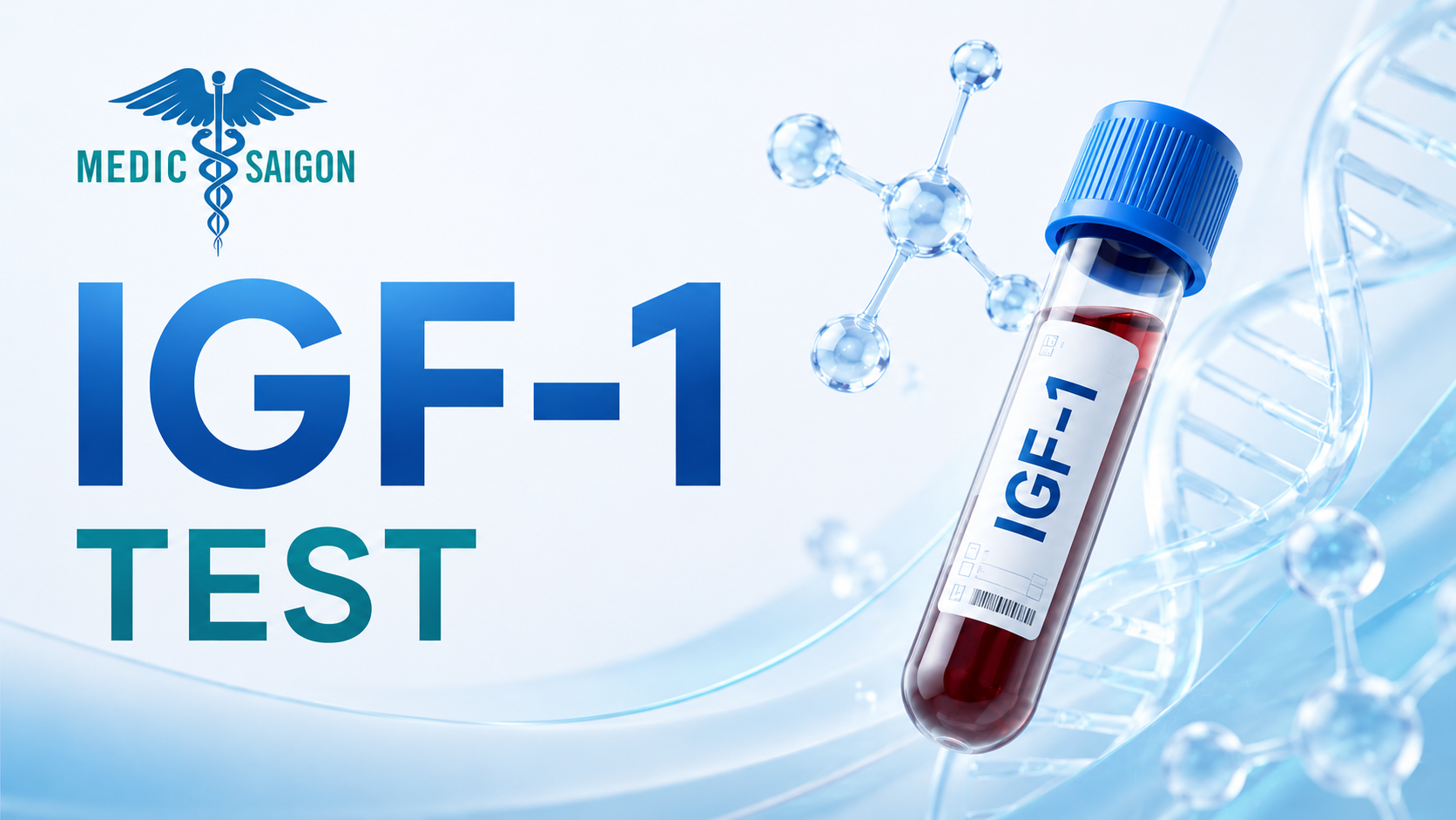 What is an IGF-1 test