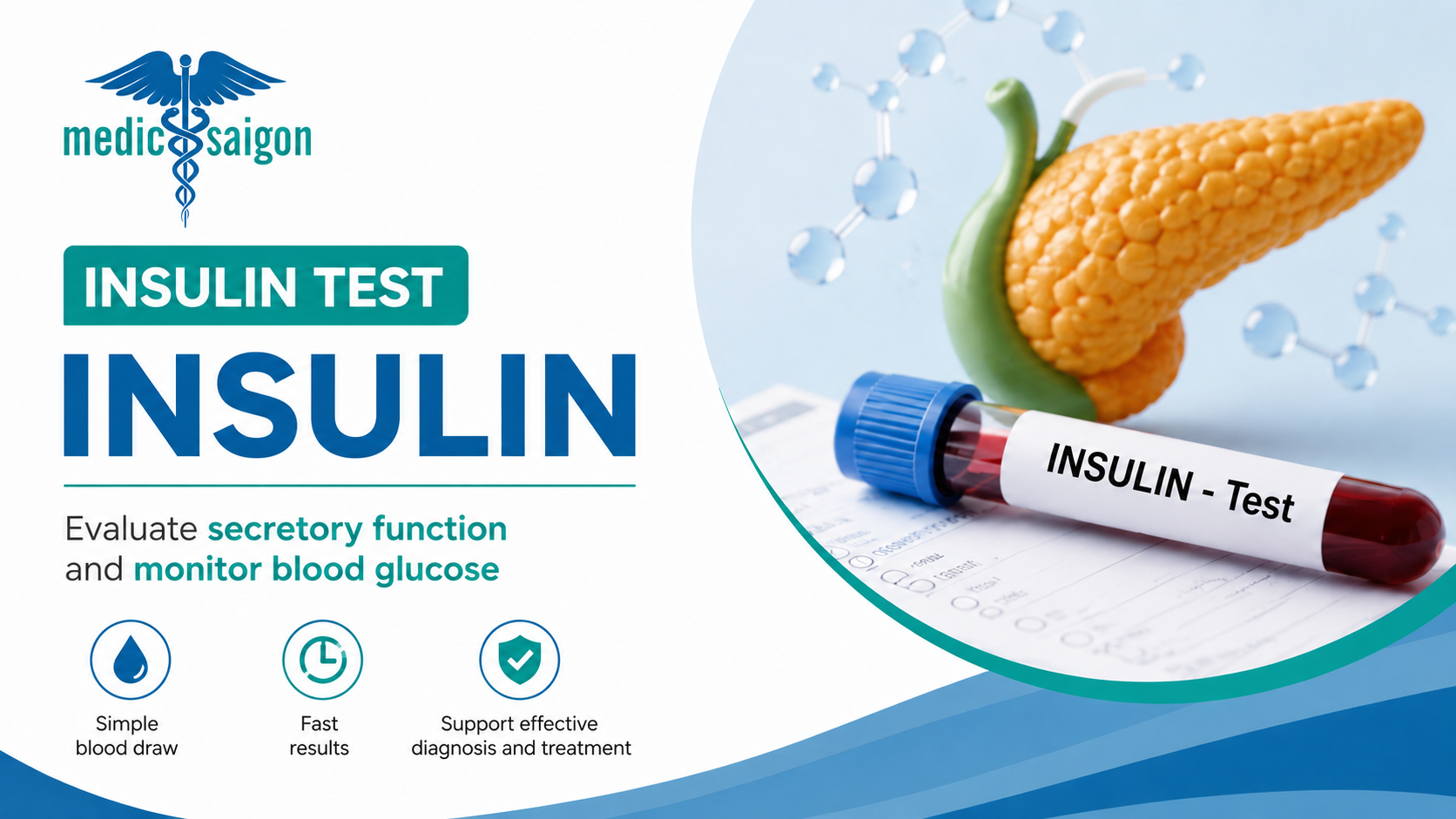 What is an Insulin Test