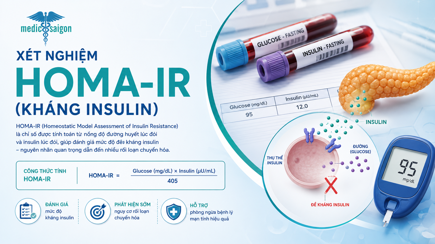 Xét nghiệm HOMA-IR (kháng insulin ) trong tầm soát bệnh tiểu đường