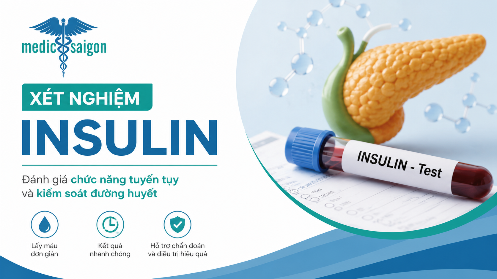Xét nghiệm Insulin là gì