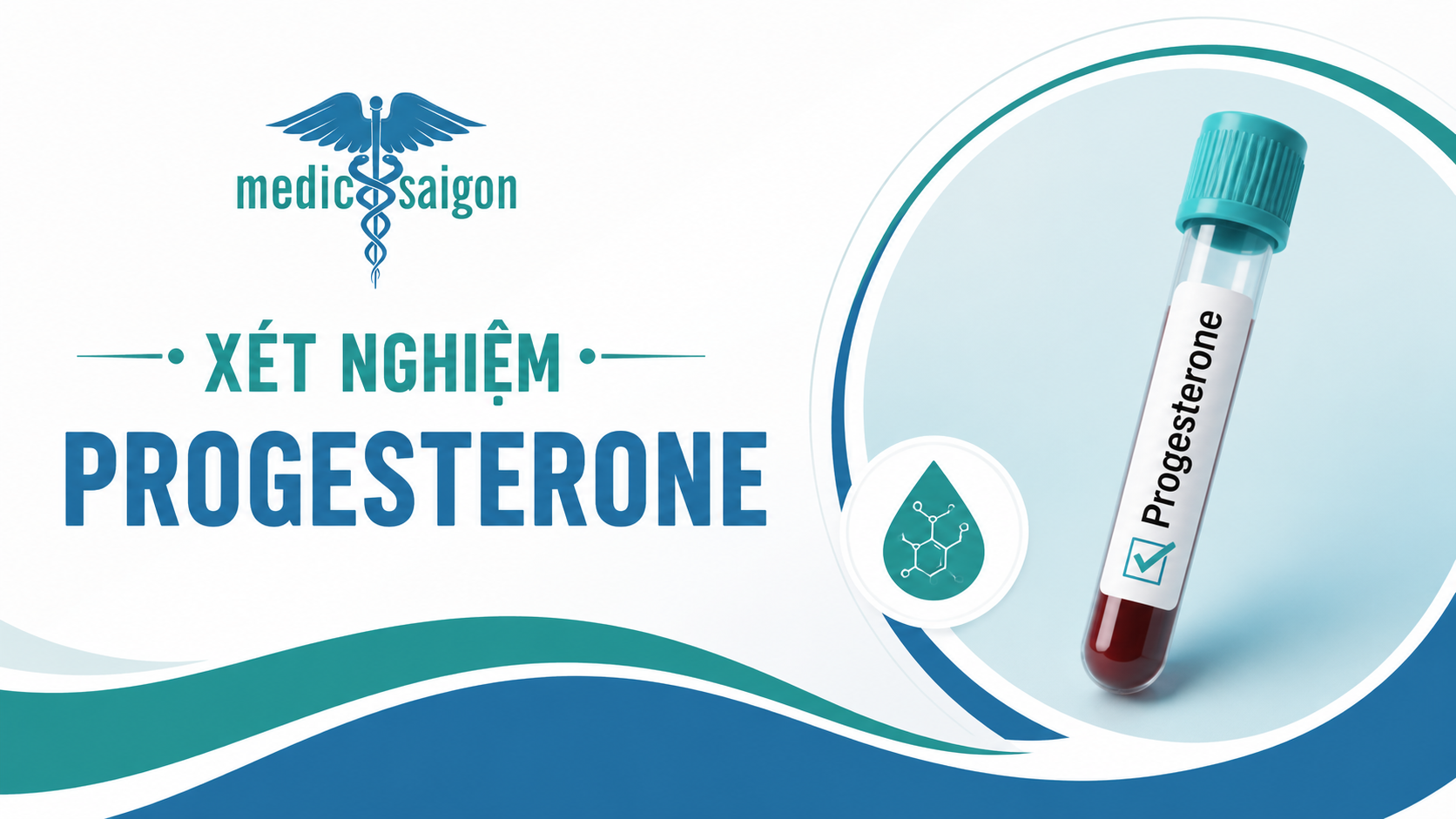 Xét nghiệm Progesterone là xét nghiệm gì