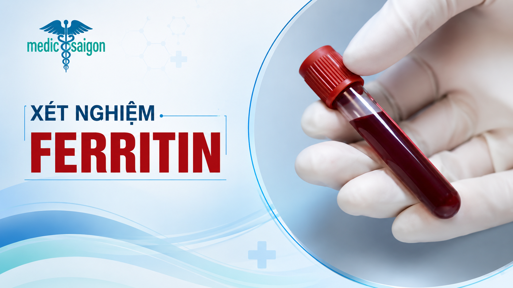 Ferritin và xét nghiệm Ferritin máu