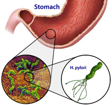 vi-khuan-helicobacter_pylori