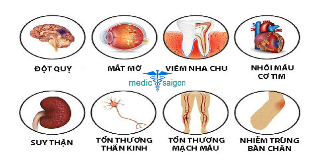 biến chứng bệnh tiểu đường