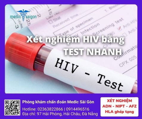 Xét nghiệm HIV bằng test nhanh tại Đà Nẵng - Phòng khám Medic