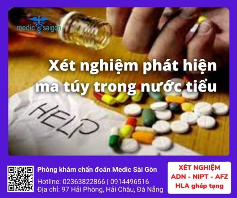 Xét nghiệm phát hiện ma túy trong nước tiểu - phòng khám Medic