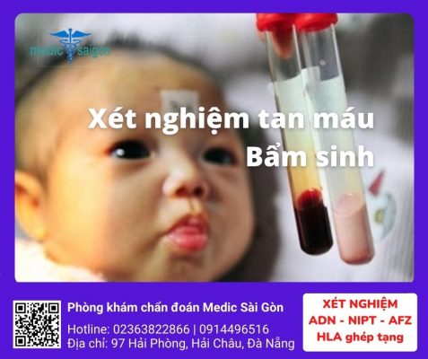 Xét nghiệm tan máu bẩm sinh tại Đà Nẵng - Phòng khám medic