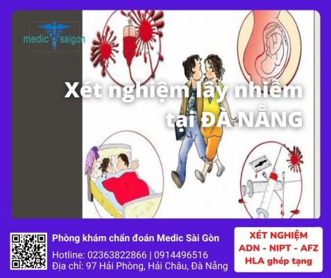 Xét nghiệm lây nhiễm tại Đà Nẵng - Phòng khám medic
