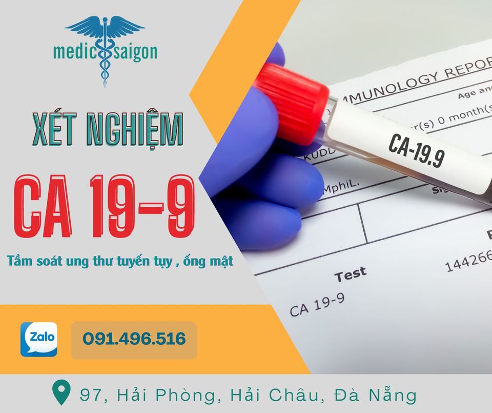 Xét nghiệm CA 19-9 hỗ trợ chẩn đoán ung thư đặc biệt ung thư tuyến tụy