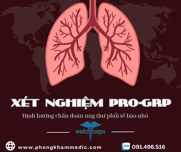 7. Những lưu ý khi thực hiện và giải thích xét nghiệm Pro-GRP