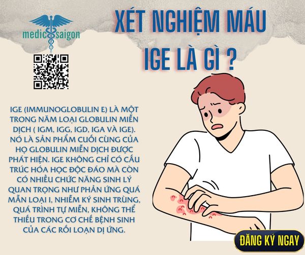 IgE là gì? Tìm hiểu về kháng thể IgE và vai trò trong các phản ứng dị ứng