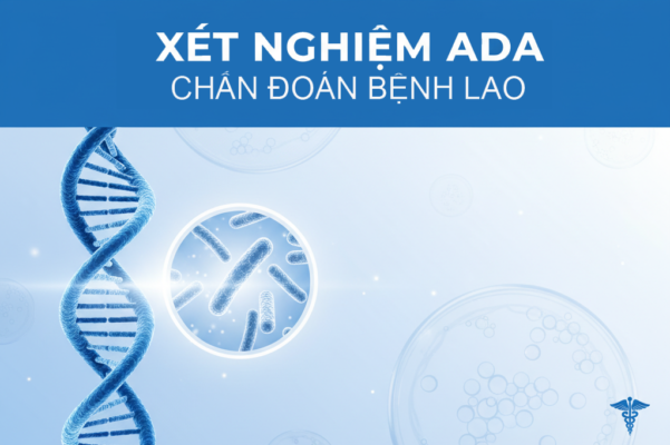 Xét nghiệm ADA hỗ trợ chẩn đoán bệnh lao