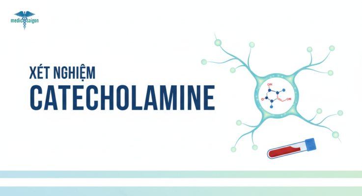 Xet-nghiem-Catecholamine-la-gi