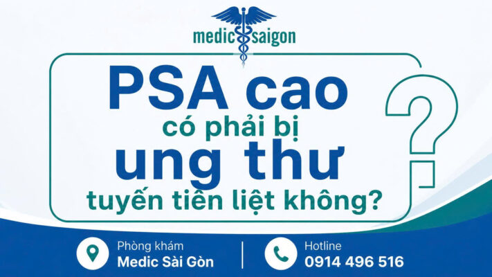 PSA cao có phải ung thư không