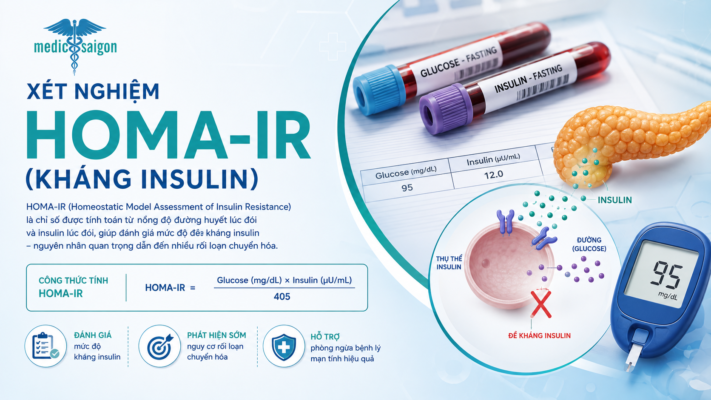 Xét nghiệm HOMA-IR (kháng insulin ) trong tầm soát bệnh tiểu đường