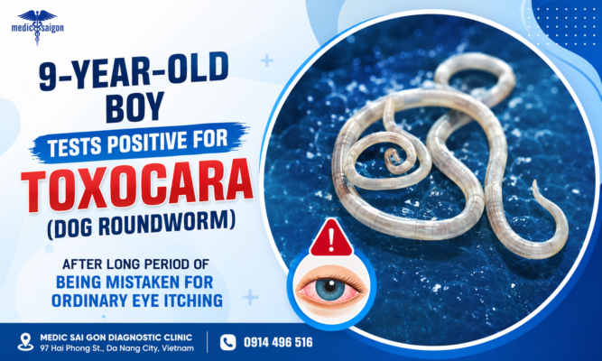 9-Year-Old Boy Tests Positive for Toxocara (Dog Roundworm)