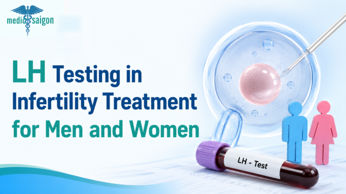  LH Testing in Infertility Treatment for Men and Women